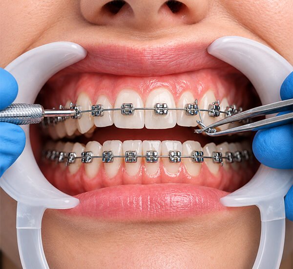 Orthodontics