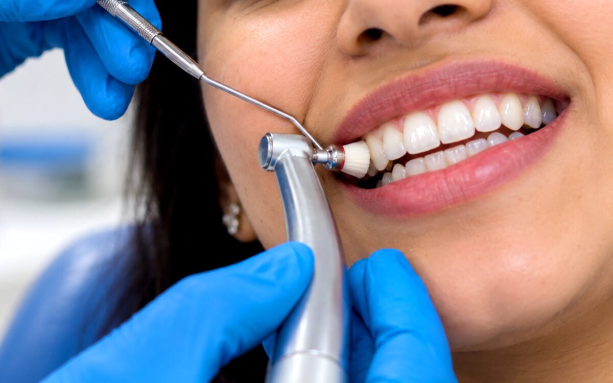 Teeth-Cleaning