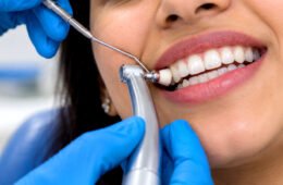Teeth Whitening in Panchkula | Cost, Benefits & Safety